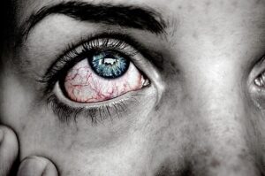eye, sick, blue, red, pain, gray eye, gray pain, sick, sick, sick, sick, sick, pain
